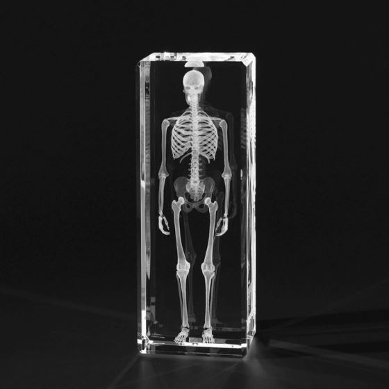 UV-Lasergravur eines 3D-Modells des menschlichen Körpers in Glas